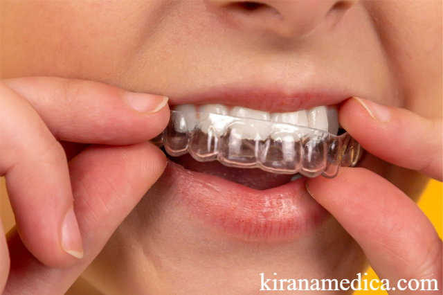 Aligner Transparan untuk Gigi Rapi Modern
